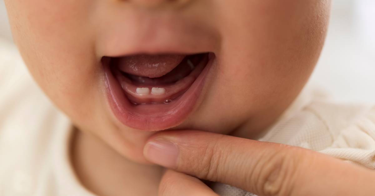 Close-up-of-a-babys-open-mouth-showing-first-teeth-with-an-adults-finger-gently-touching-the-lower-gum
