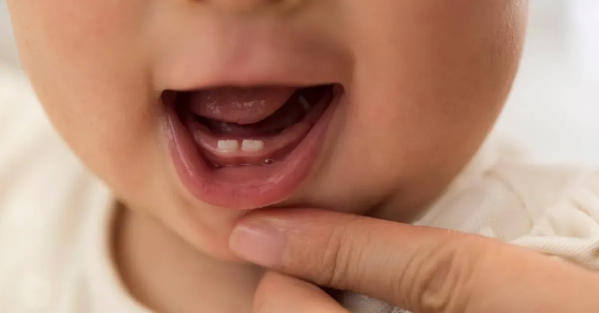 Close-up-of-a-babys-open-mouth-showing-first-teeth-with-an-adults-finger-gently-touching-the-lower-gum